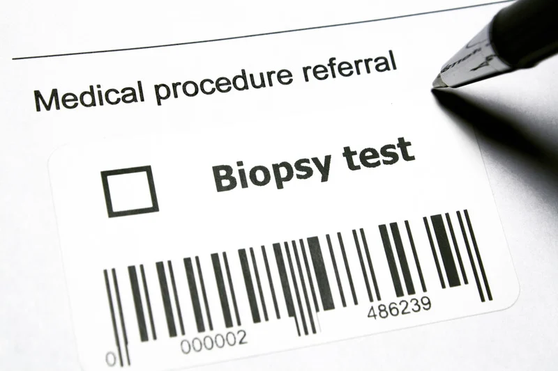 biopsy test img